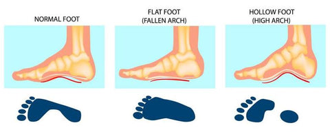 High Arch Shoes