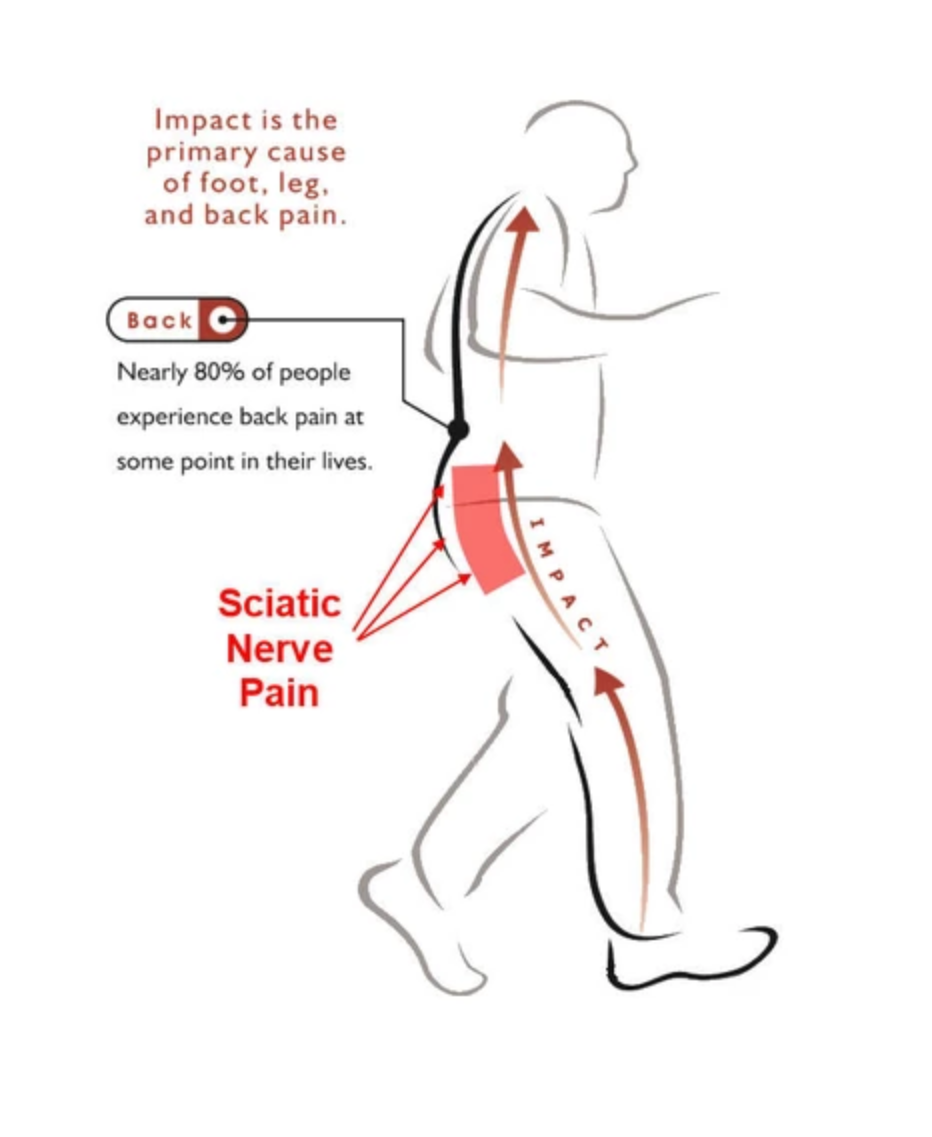 Sciatica Shoes